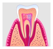 root_canal1